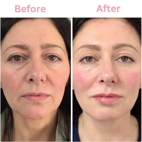 Kosrx™ Bio-Glow Collagen Mask