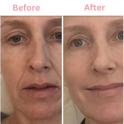 Kosrx™ Bio-Glow Collagen Mask