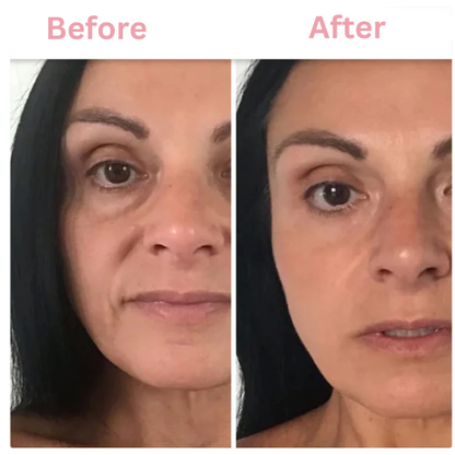 Kosrx™ Bio-Glow Collagen Mask