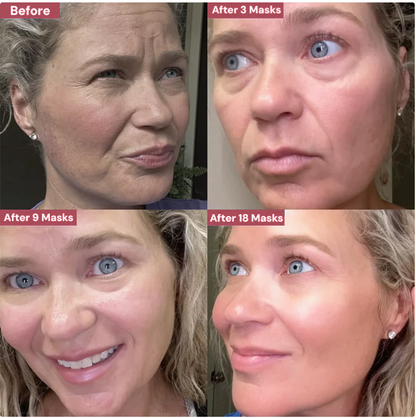 Kosrx™ Bio-Glow Collagen Mask